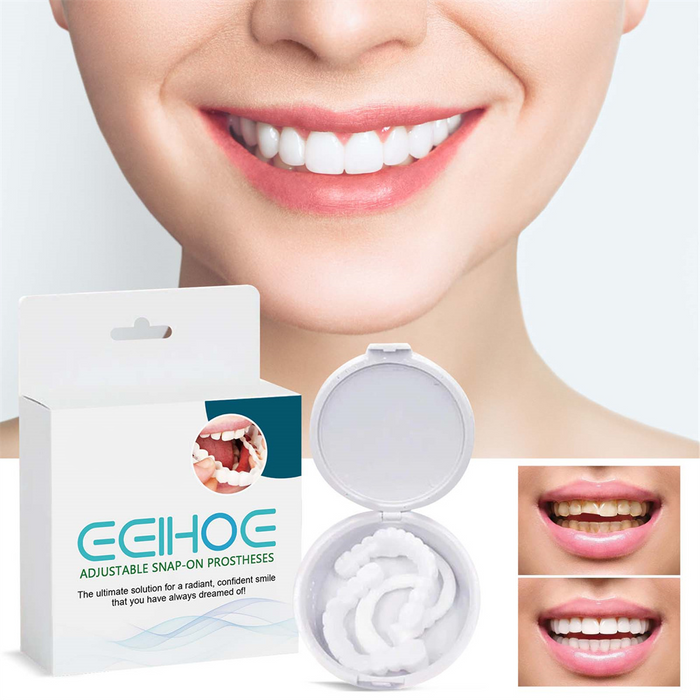 BeautySmile - Facetas Dentárias Removíveis - ElyComfort